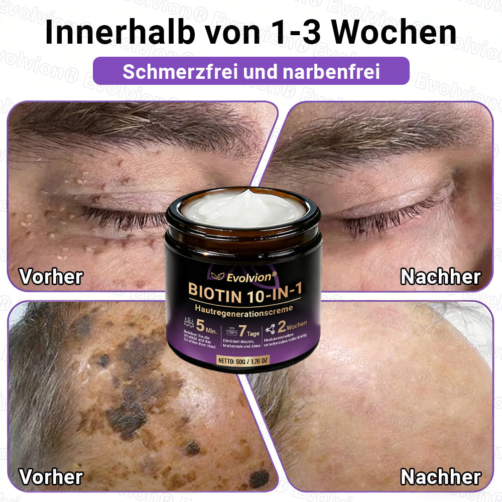 Hergestellt und versendet aus Deutschland ✨ Evolvion® Biotin 10-in-1 Hautrestaurationscreme 🔥🔥