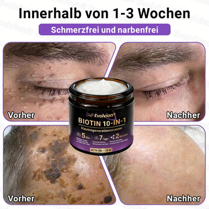 Hergestellt und versendet aus Deutschland ✨ Evolvion® Biotin 10-in-1 Hautrestaurationscreme 🔥🔥