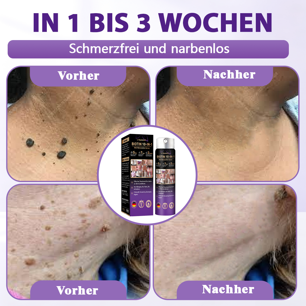 Hergestellt und versandt aus Deutschland ✨Evolvion® Biotin 10-in-1 Hautregenerations-Spray 🌵🌵