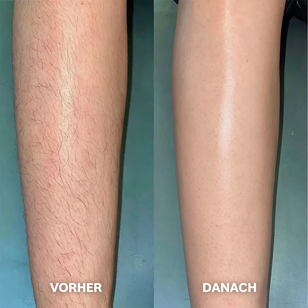 Haarentfernungscreme für Frauen und Männer
