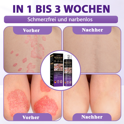 Hergestellt und versandt aus Deutschland ✨Evolvion® Biotin 10-in-1 Hautregenerations-Spray 🌵🌵