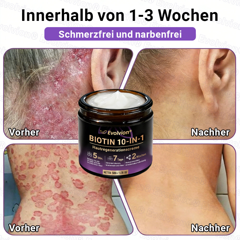 Hergestellt und versendet aus Deutschland ✨ Evolvion® Biotin 10-in-1 Hautrestaurationscreme 🔥🔥