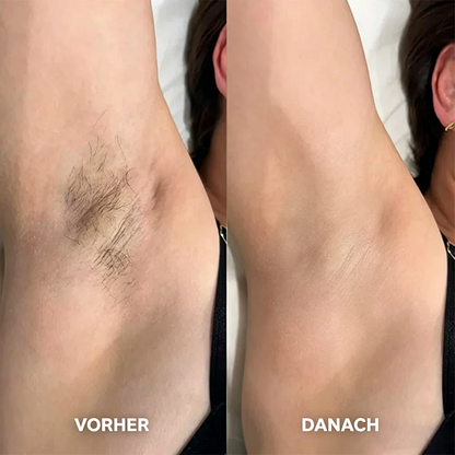 Haarentfernungscreme für Frauen und Männer