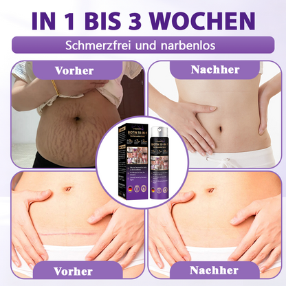 Hergestellt und versandt aus Deutschland ✨Evolvion® Biotin 10-in-1 Hautregenerations-Spray 🌵🌵