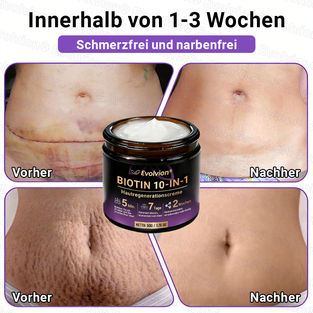 Hergestellt und versendet aus Deutschland ✨ Evolvion® Biotin 10-in-1 Hautrestaurationscreme 🔥🔥