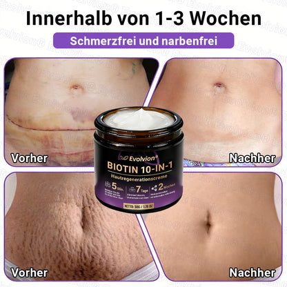Hergestellt und versendet aus Deutschland ✨ Evolvion® Biotin 10-in-1 Hautrestaurationscreme 🔥🔥