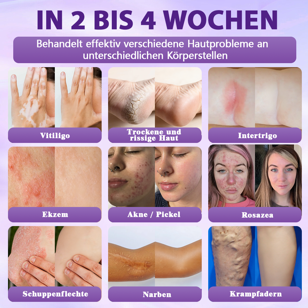 Hergestellt und versandt aus Deutschland ✨Evolvion® Biotin 10-in-1 Hautregenerations-Spray 🌵🌵