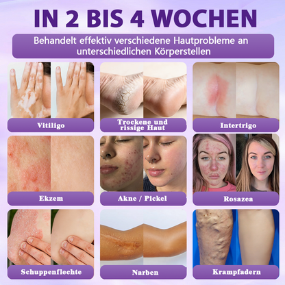 Hergestellt und versandt aus Deutschland ✨Evolvion® Biotin 10-in-1 Hautregenerations-Spray 🌵🌵