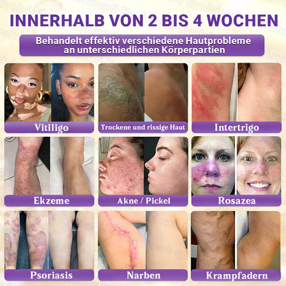 Hergestellt und versendet aus Deutschland ✨ Evolvion® Biotin 10-in-1 Hautrestaurationscreme 🔥🔥