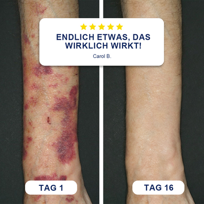 ✨Evolvion® Bluterguss-Reparatur- & hautstärkende Creme 🌼