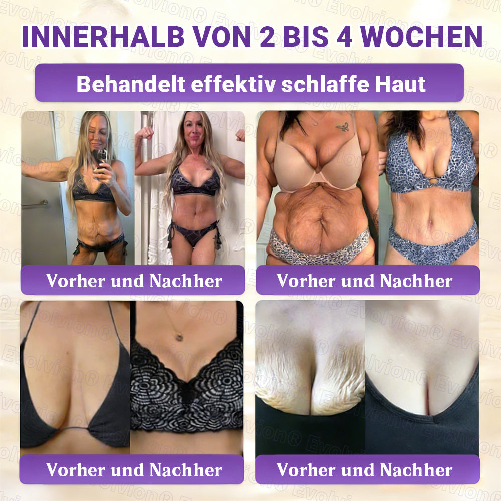 Hergestellt und versendet aus Deutschland ✨ Evolvion® Biotin 10-in-1 Hautrestaurationscreme 🔥🔥