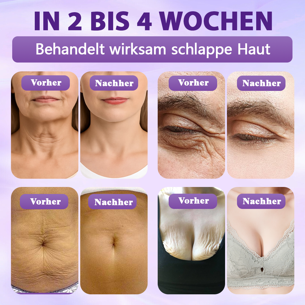 Hergestellt und versandt aus Deutschland ✨Evolvion® Biotin 10-in-1 Hautregenerations-Spray 🌵🌵