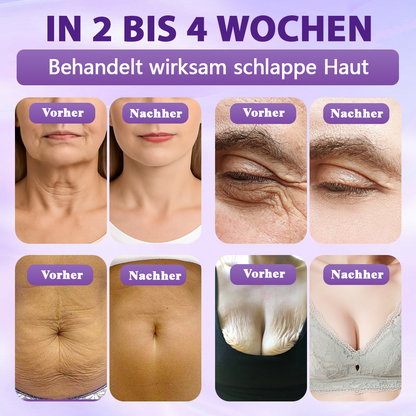 Hergestellt und versandt aus Deutschland ✨Evolvion® Biotin 10-in-1 Hautregenerations-Spray 🌵🌵