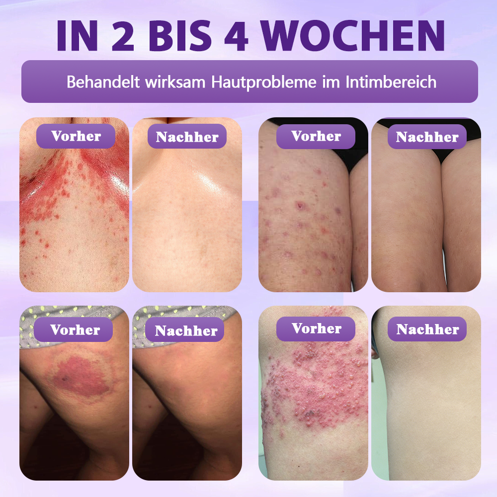 Hergestellt und versandt aus Deutschland ✨Evolvion® Biotin 10-in-1 Hautregenerations-Spray 🌵🌵