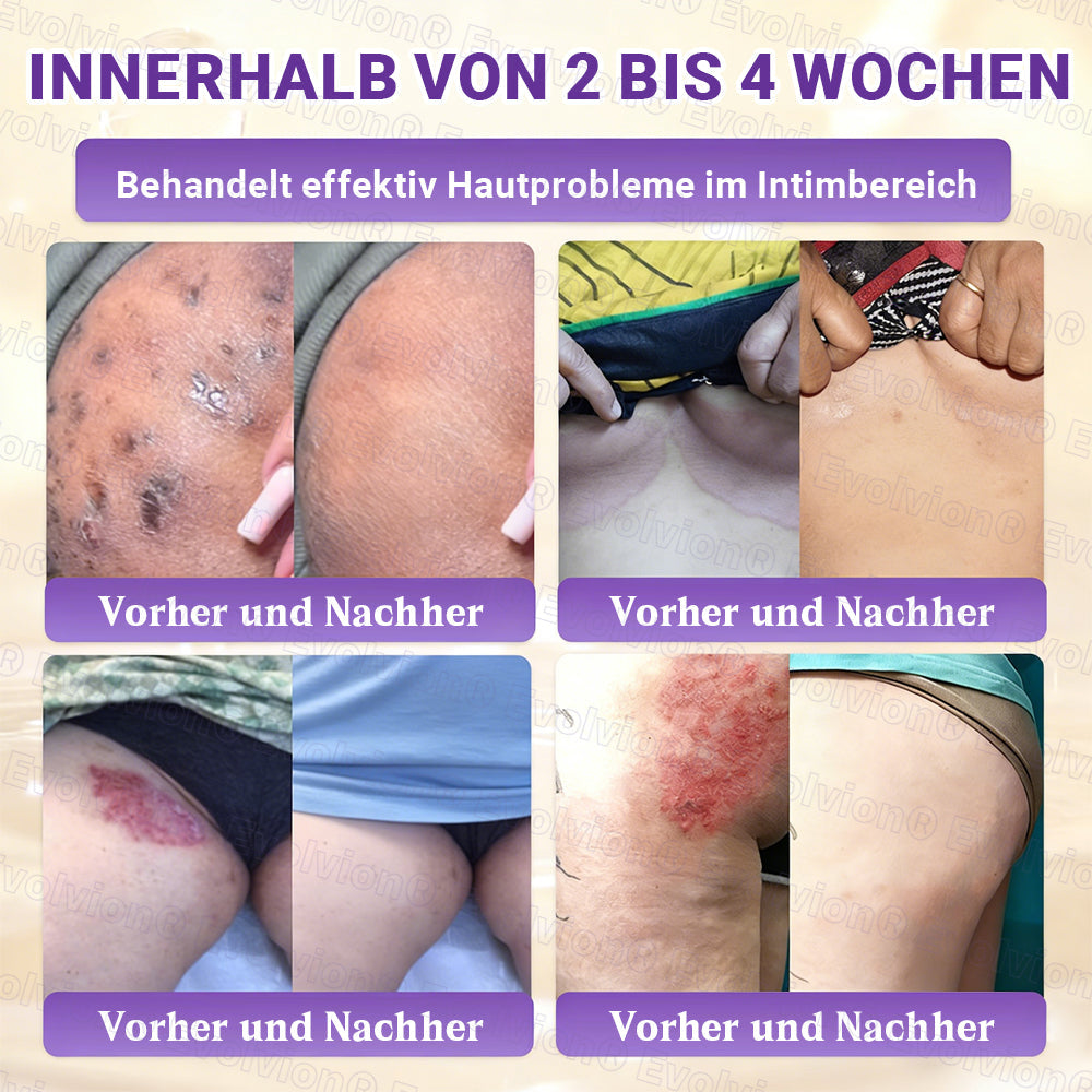 Hergestellt und versendet aus Deutschland ✨ Evolvion® Biotin 10-in-1 Hautrestaurationscreme 🔥🔥
