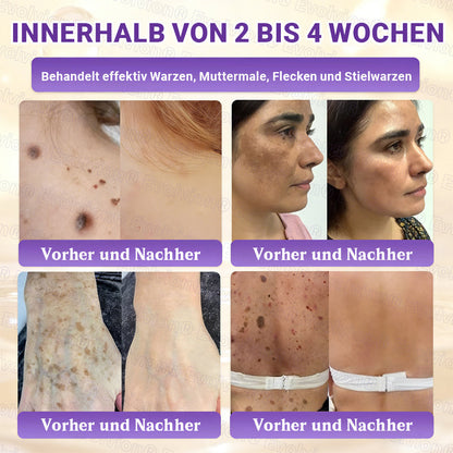 Hergestellt und versendet aus Deutschland ✨ Evolvion® Biotin 10-in-1 Hautrestaurationscreme 🔥🔥