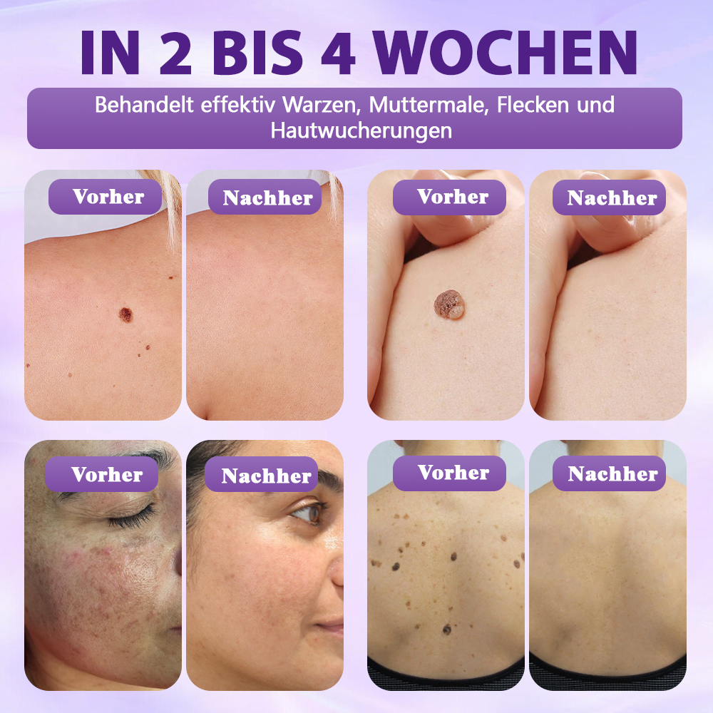 Hergestellt und versandt aus Deutschland ✨Evolvion® Biotin 10-in-1 Hautregenerations-Spray 🌵🌵