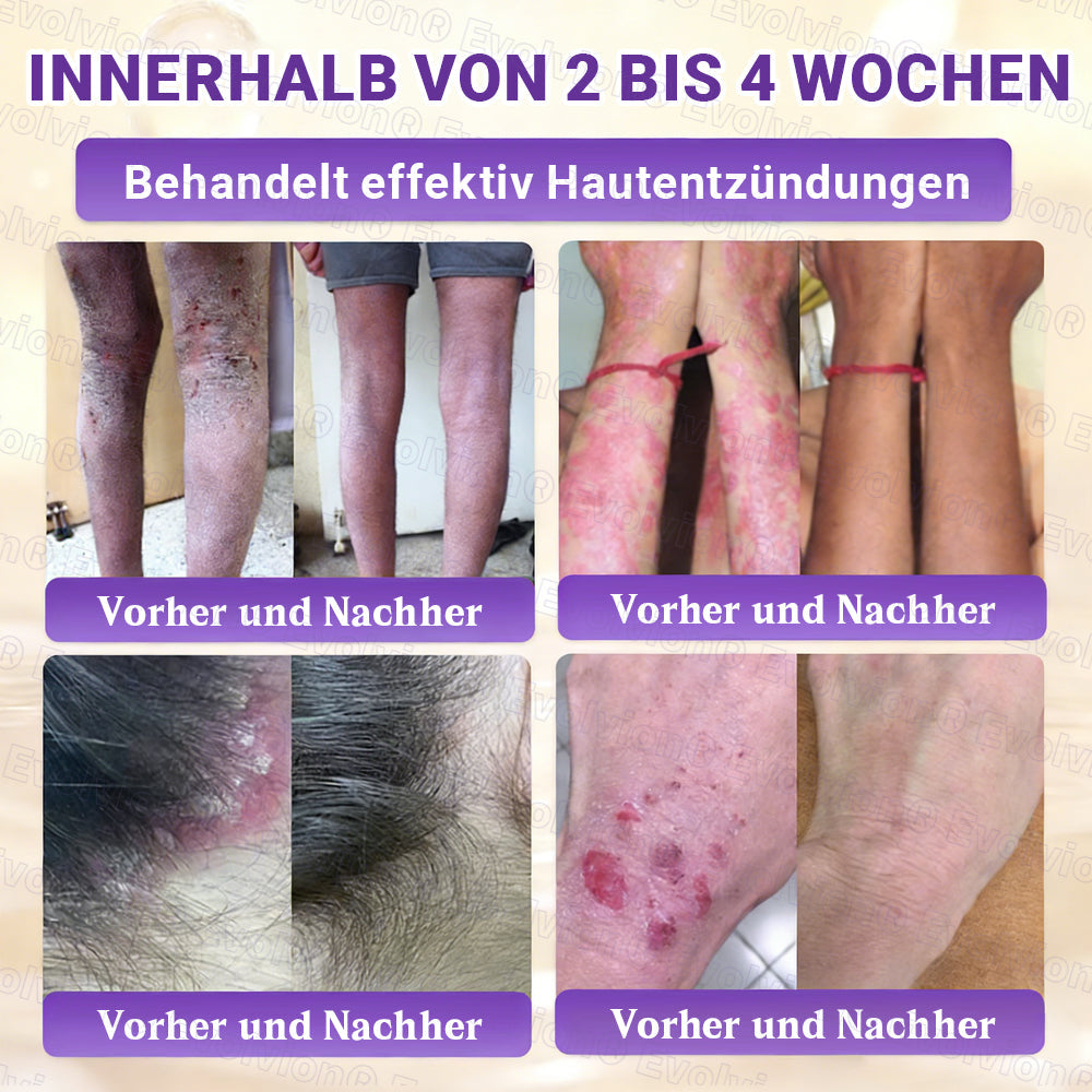 Hergestellt und versendet aus Deutschland ✨ Evolvion® Biotin 10-in-1 Hautrestaurationscreme 🔥🔥