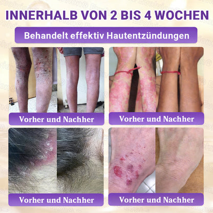 Hergestellt und versendet aus Deutschland ✨ Evolvion® Biotin 10-in-1 Hautrestaurationscreme 🔥🔥