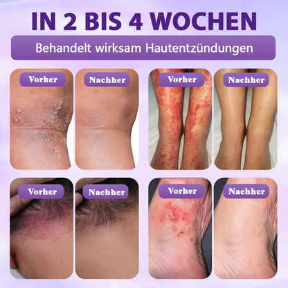 Hergestellt und versandt aus Deutschland ✨Evolvion® Biotin 10-in-1 Hautregenerations-Spray 🌵🌵