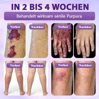 Hergestellt und versandt aus Deutschland ✨Evolvion® Biotin 10-in-1 Hautregenerations-Spray 🌵🌵