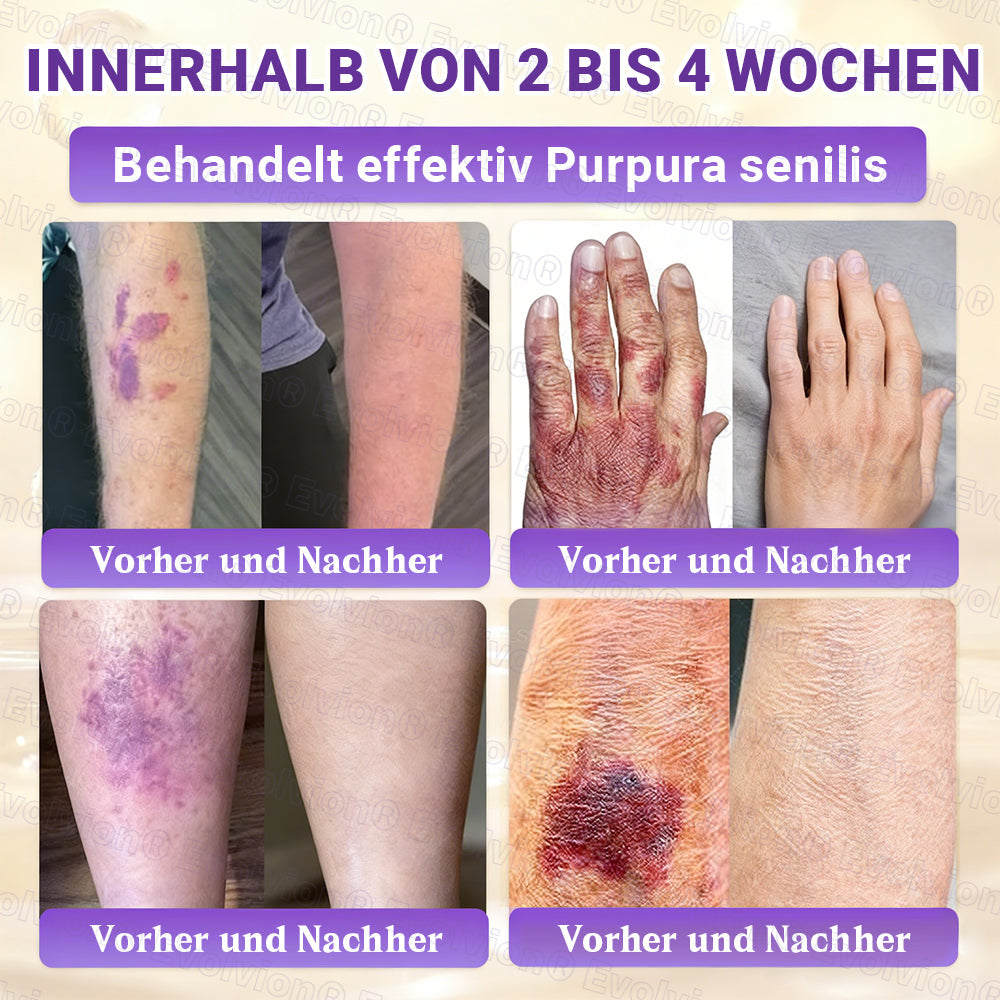 Hergestellt und versendet aus Deutschland ✨ Evolvion® Biotin 10-in-1 Hautrestaurationscreme 🔥🔥