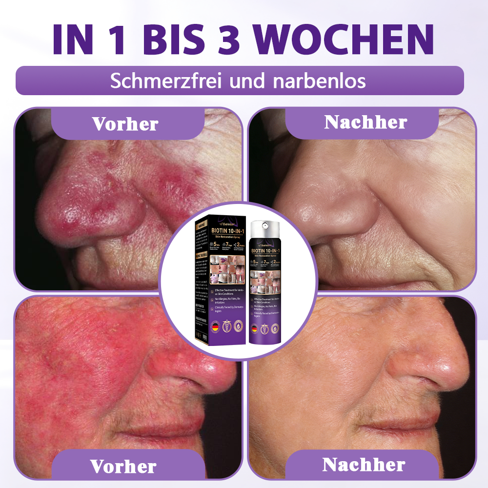 Hergestellt und versandt aus Deutschland ✨Evolvion® Biotin 10-in-1 Hautregenerations-Spray 🌵🌵