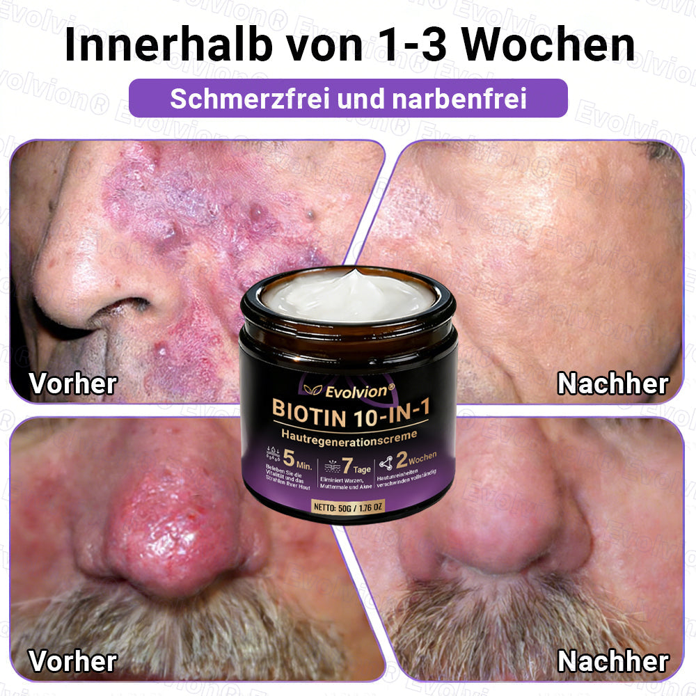 Hergestellt und versendet aus Deutschland ✨ Evolvion® Biotin 10-in-1 Hautrestaurationscreme 🔥🔥