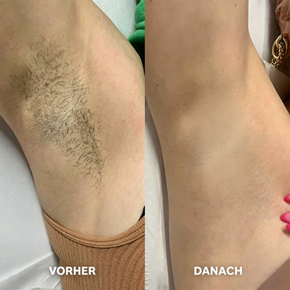 Haarentfernungscreme für Frauen und Männer