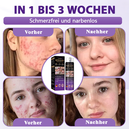 Hergestellt und versandt aus Deutschland ✨Evolvion® Biotin 10-in-1 Hautregenerations-Spray 🌵🌵