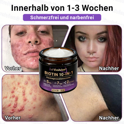 Hergestellt und versendet aus Deutschland ✨ Evolvion® Biotin 10-in-1 Hautrestaurationscreme 🔥🔥